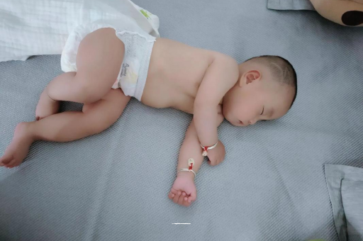 阜新六个月宝宝眼睛散光